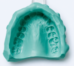 Zetalgin dust free dental alginate 453 g - Image 3